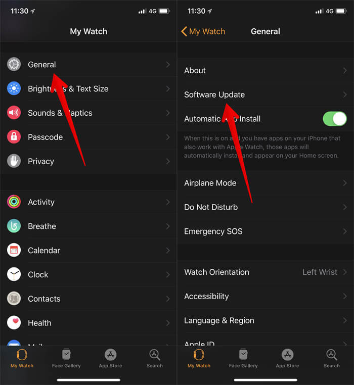 Tap on General and Software Update in iPhone Apple Watch App